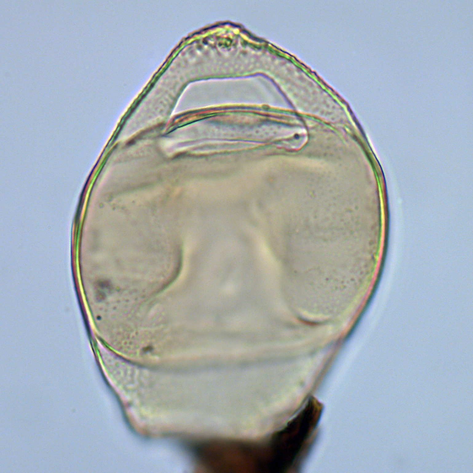 Isabelidinium cretaceum, U1581-28R2W, 14-18, sl. 1, E33, foto-b.jpg